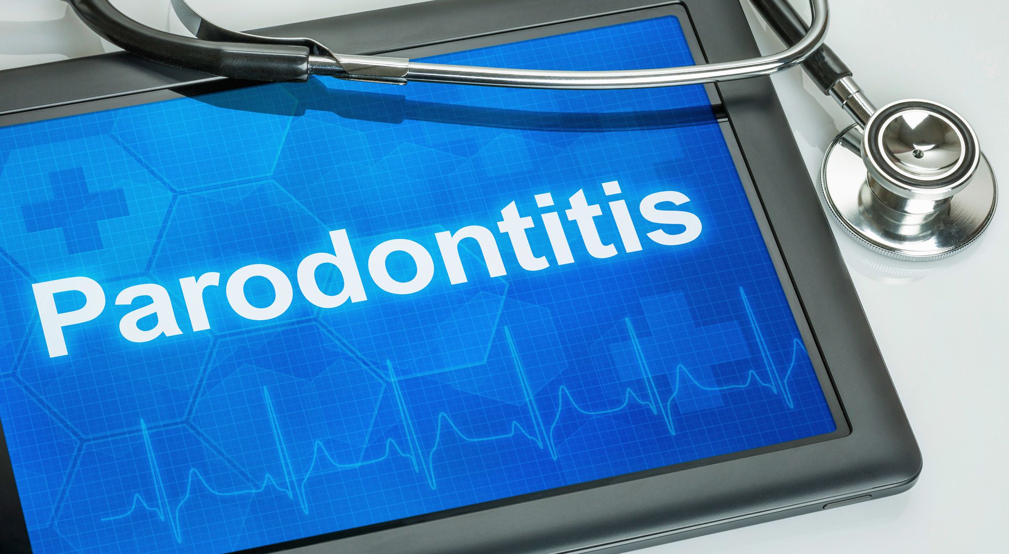 © Zerbor - Fotolia.com